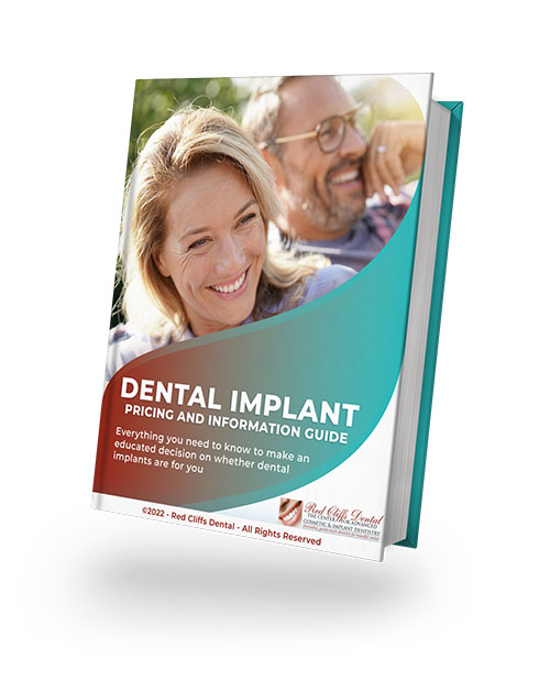 Dental Implant Pricing Guide