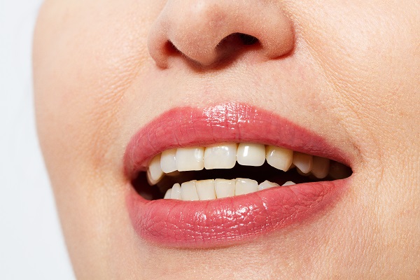 How Long Does Dental Botox® Last?