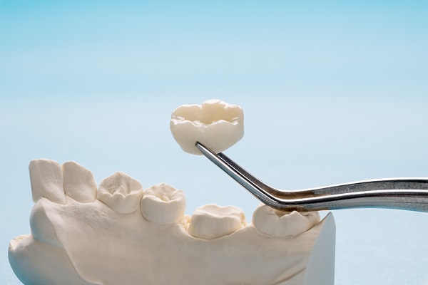 How Many Visits Does It Take To Get A Dental Crown?