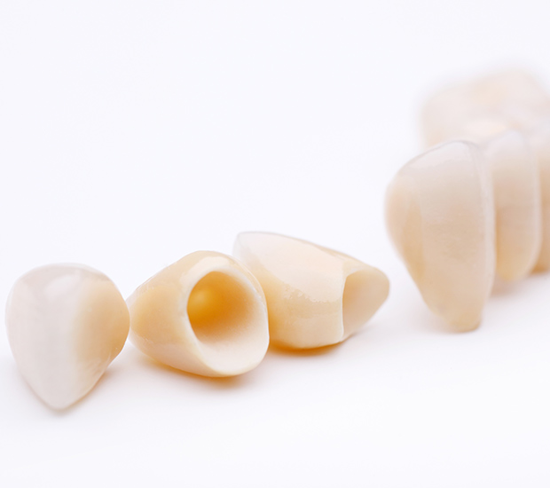 St. George Dental Crowns and Dental Bridges