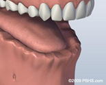 dental implants