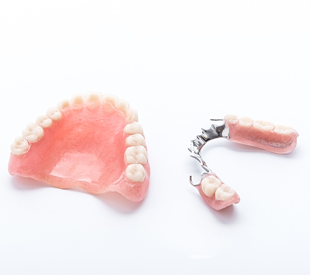 St. George Partial Dentures for Back Teeth