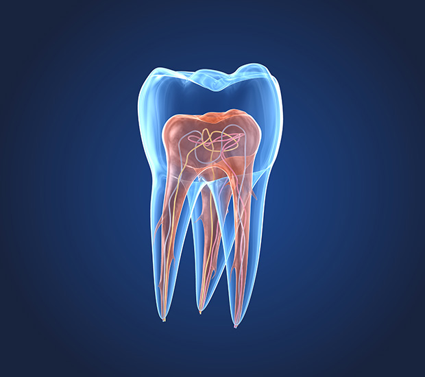 St. George What is an Endodontist