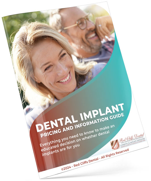 Dental Implant Pricing Guide